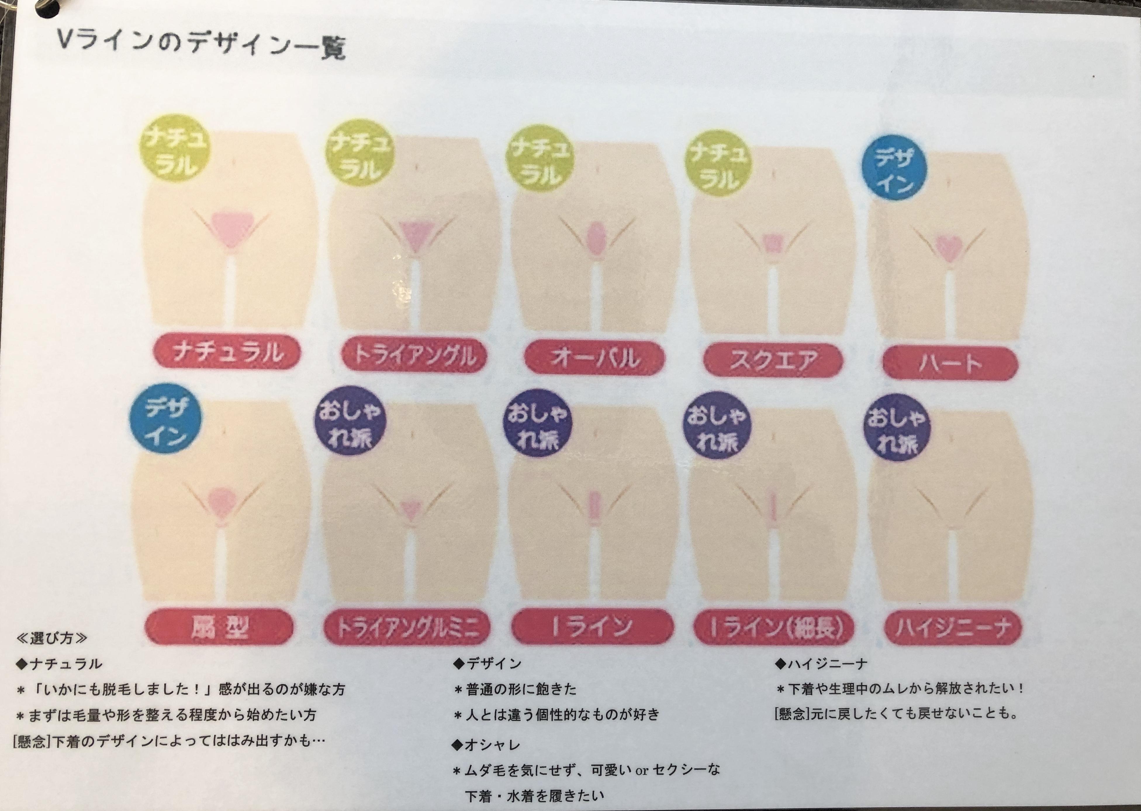 最新 脱毛 V ライン 形 カックス