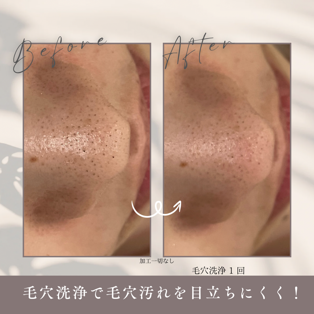 期間 1.5ヶ月.PNG