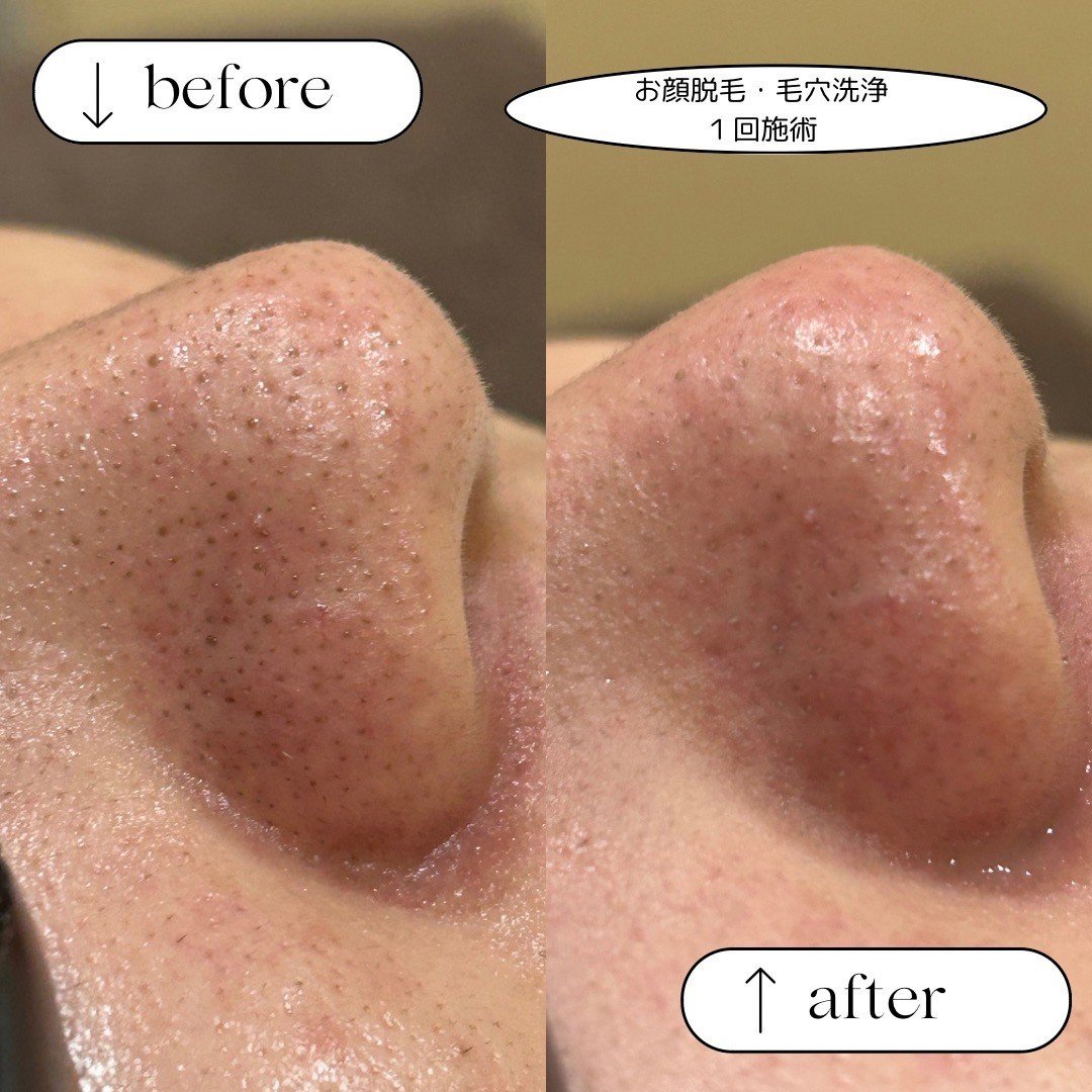 LINE_ALBUM_SNS画像_240820_38.jpg