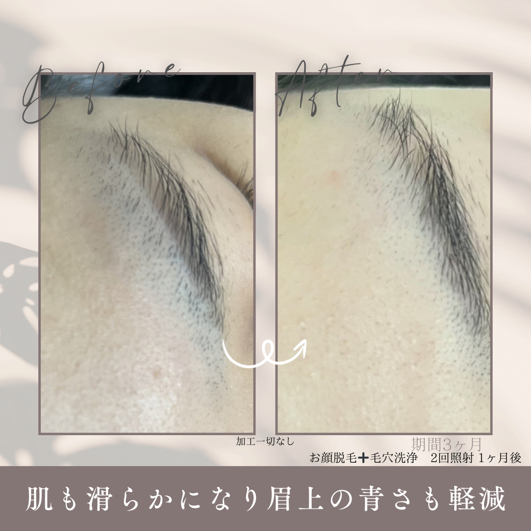期間 1.5ヶ月.png.PNG
