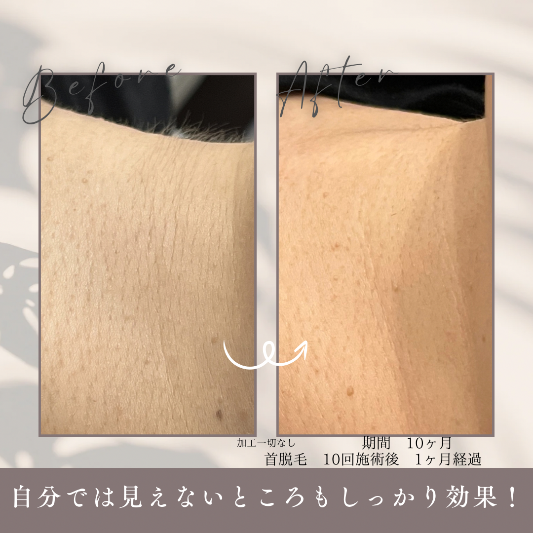 期間 1.5ヶ月.PNG
