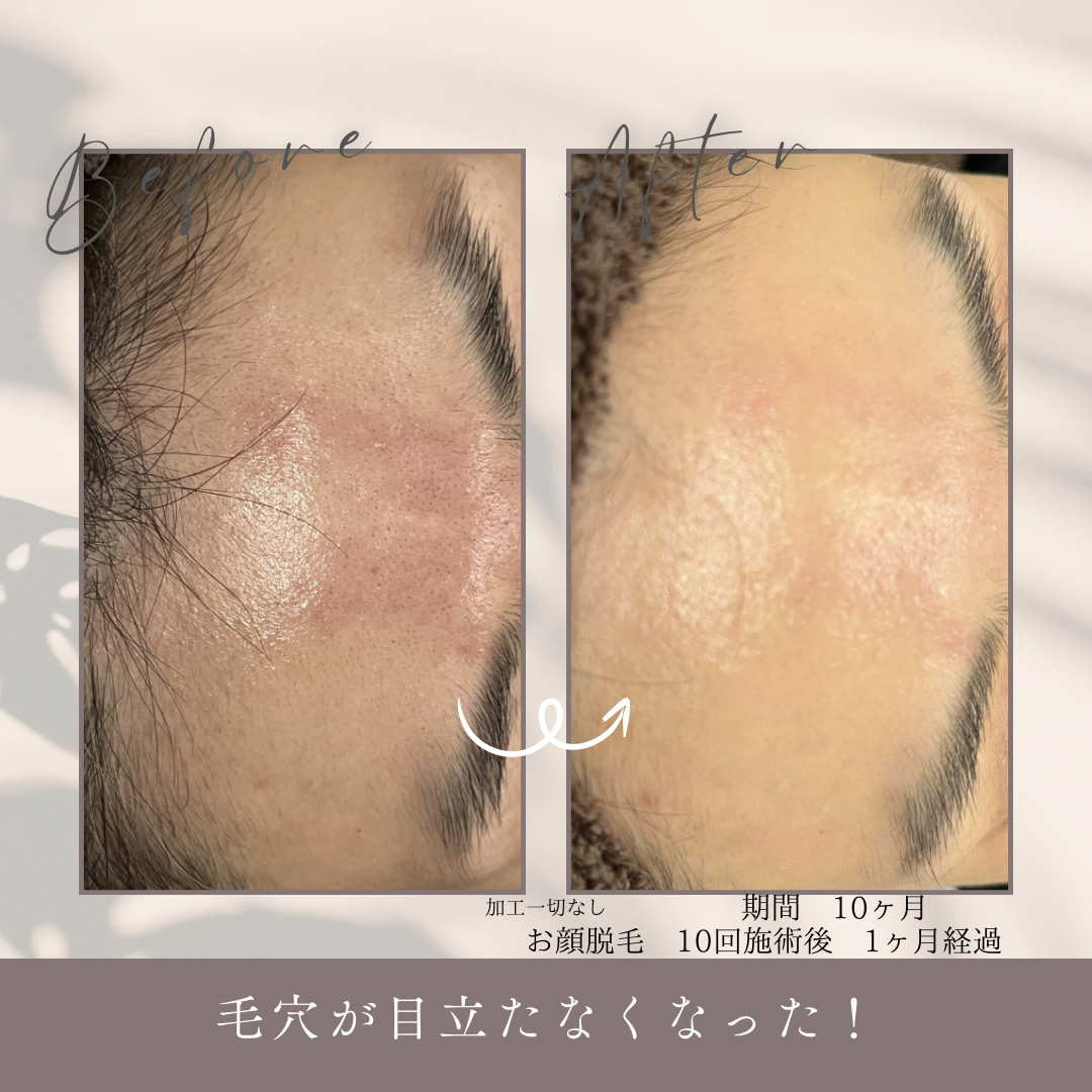 期間 1.5ヶ月.PNG