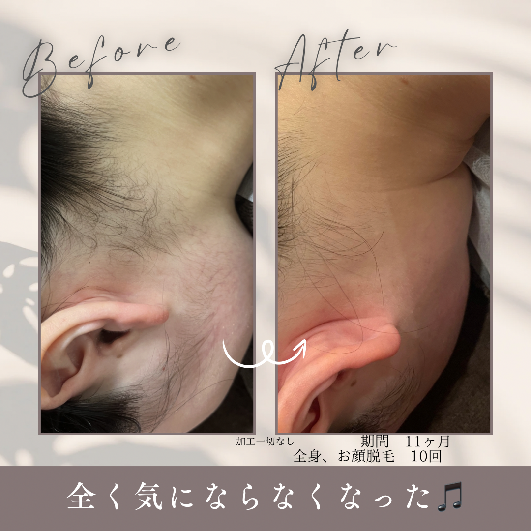 期間 1.5ヶ月.PNG