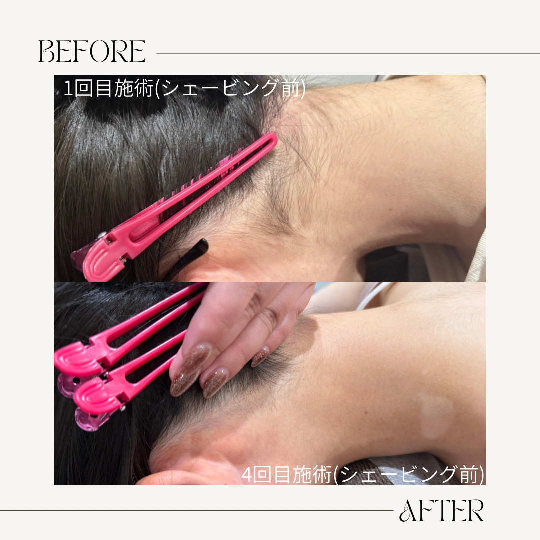Beige Brown Neutral Before + After Instagram Post.png