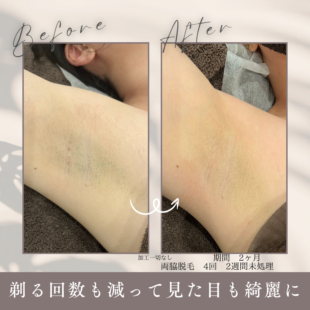 期間 1.5ヶ月.PNG