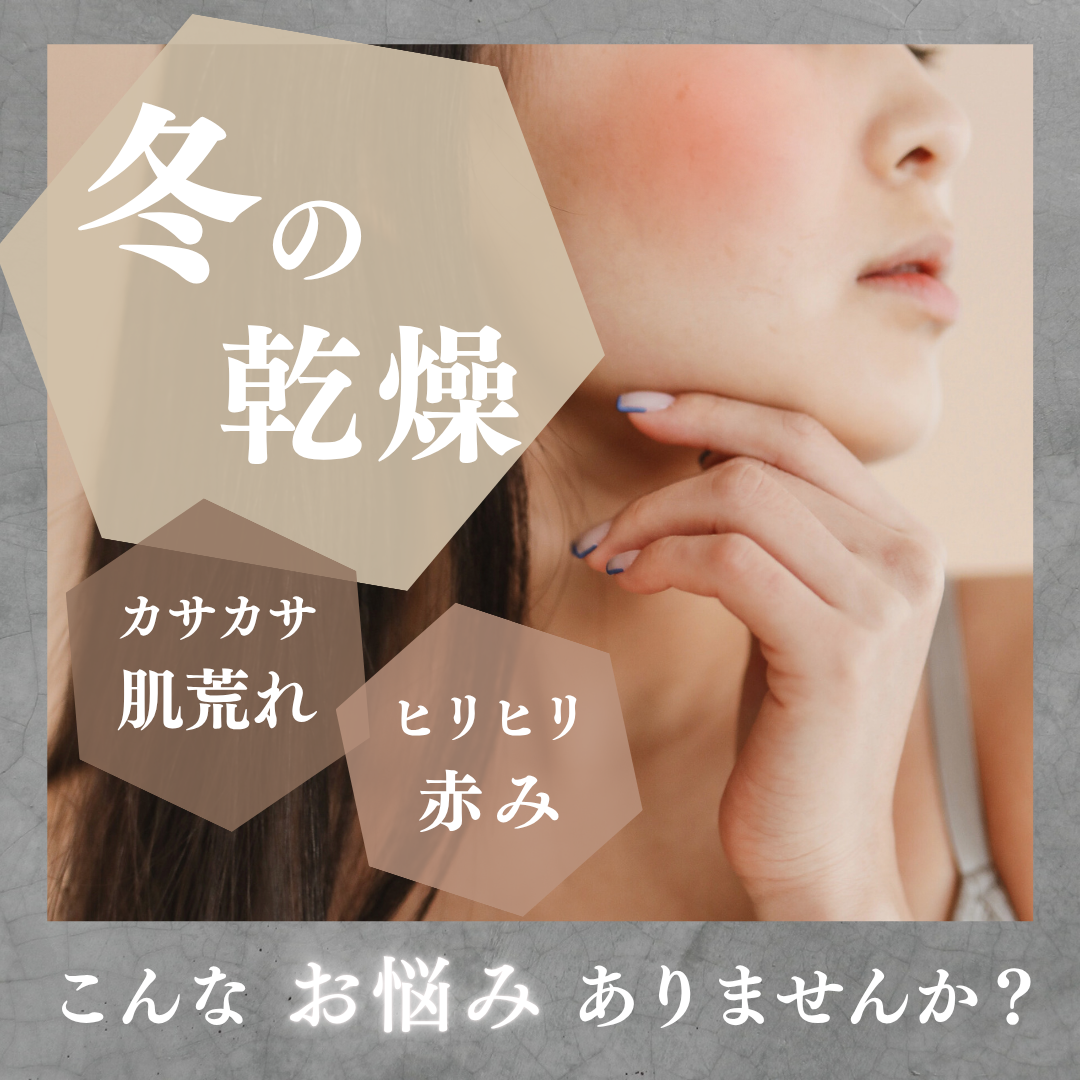 グレー ベージュ シンプル 冬 悩み 乾燥肌 Instagram 投稿 正方形.png.PNG