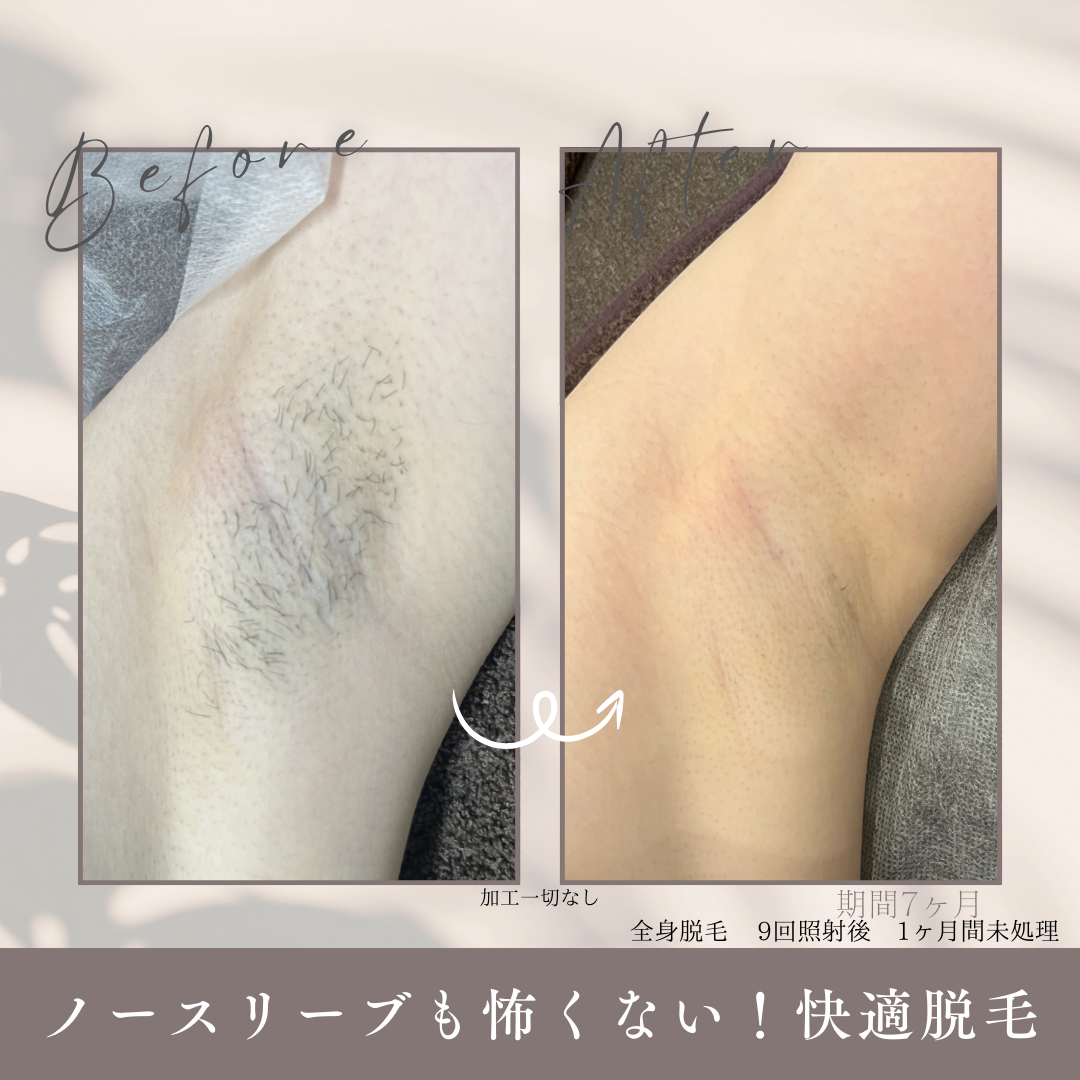 期間 1.5ヶ月.png.PNG