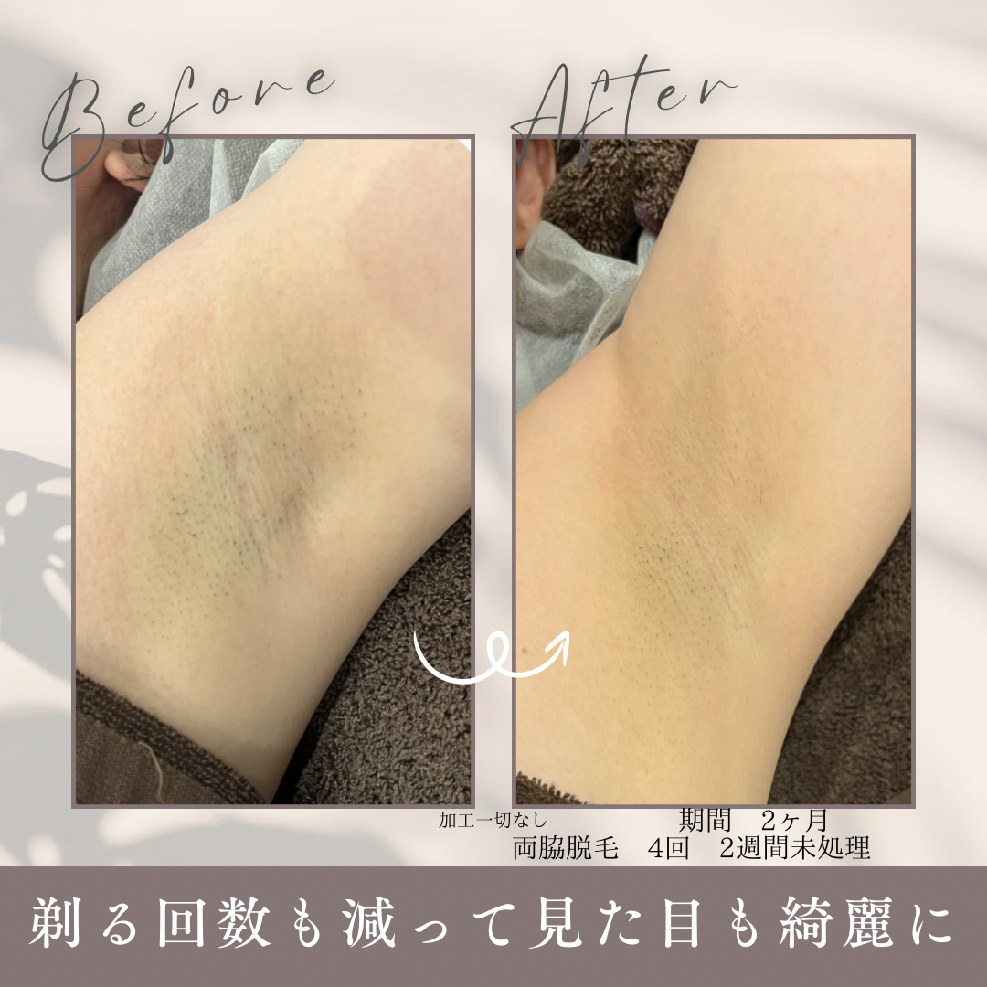 期間 1.5ヶ月.PNG