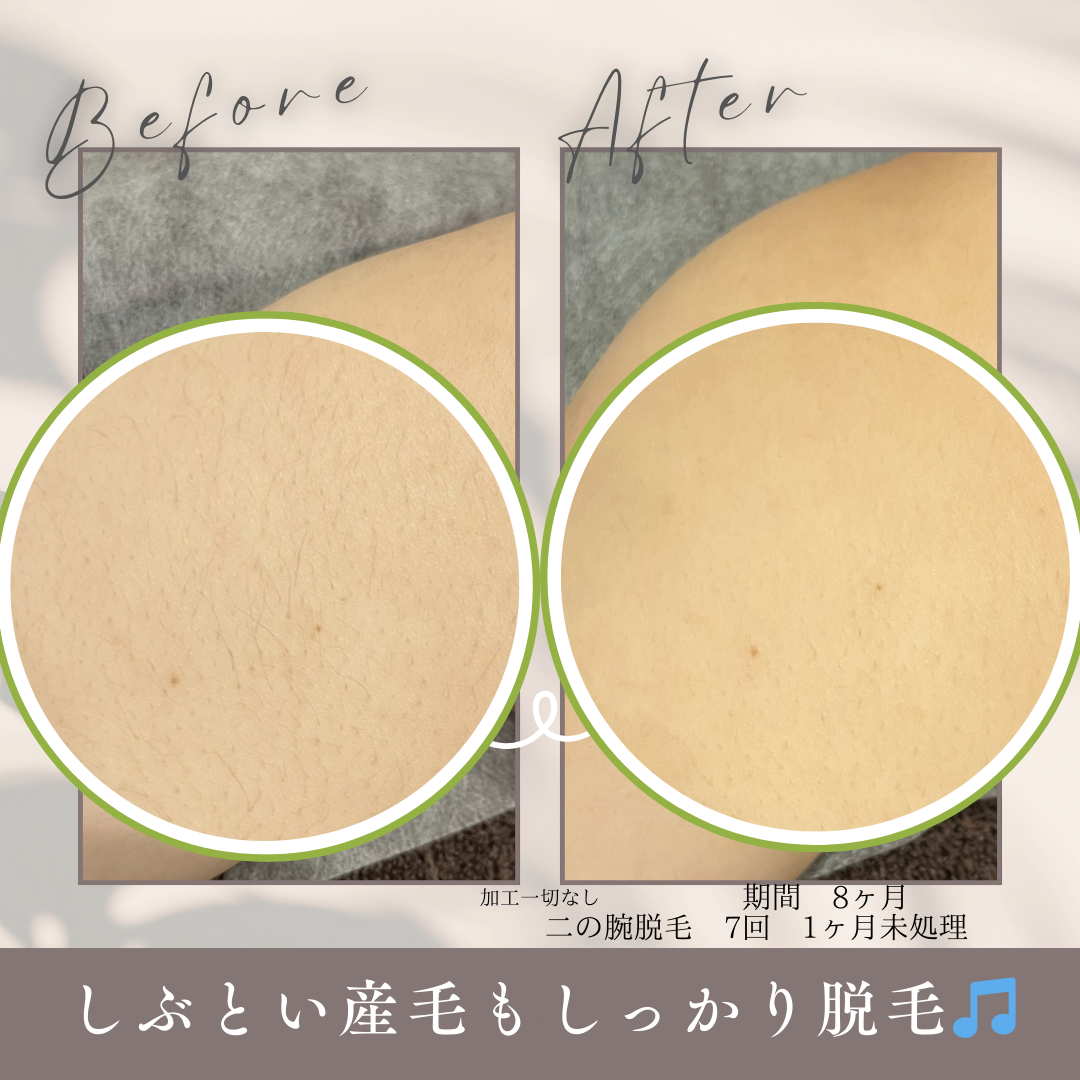 期間 1.5ヶ月.png.PNG