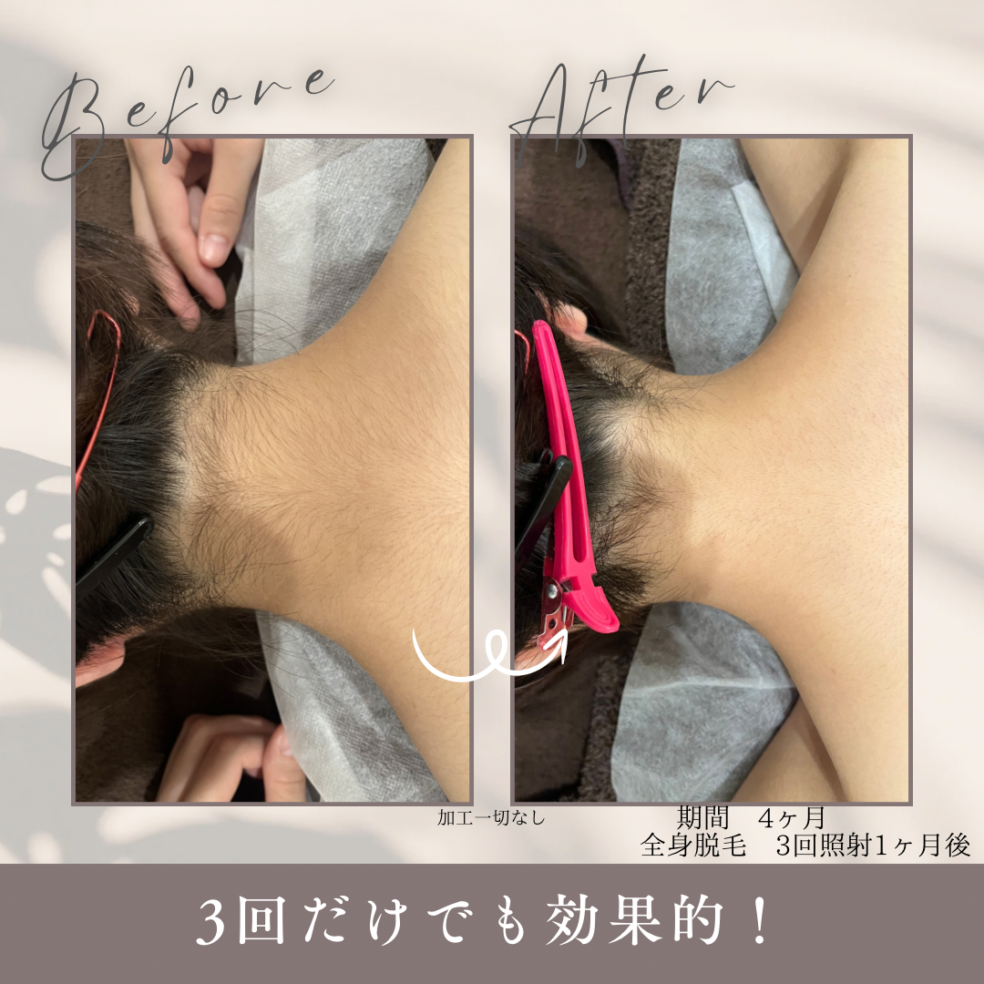 期間 1.5ヶ月.PNG