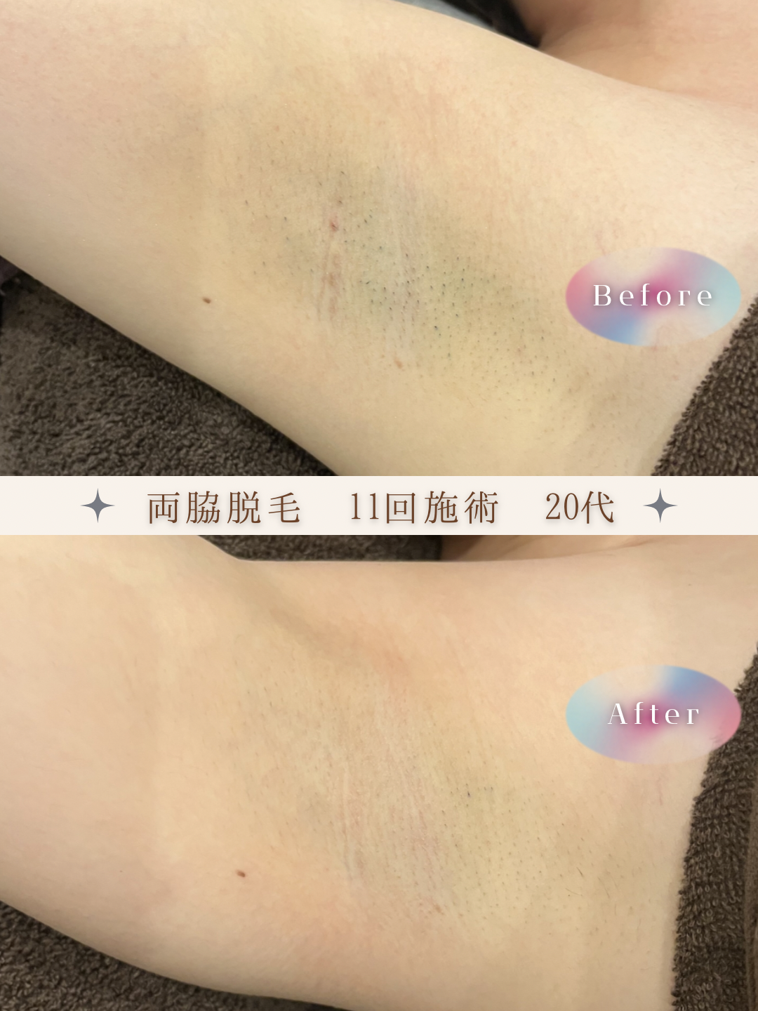 ブラウン　シンプル　美容　ビフォーアフター　写真　Instagram投稿　 (Instagramの投稿（34）).PNG