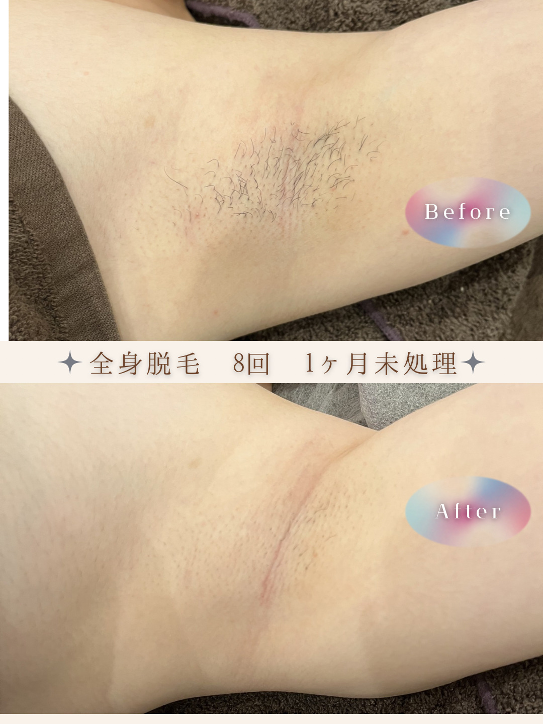 ブラウン　シンプル　美容　ビフォーアフター　写真　Instagram投稿　 (Instagramの投稿（34）).PNG