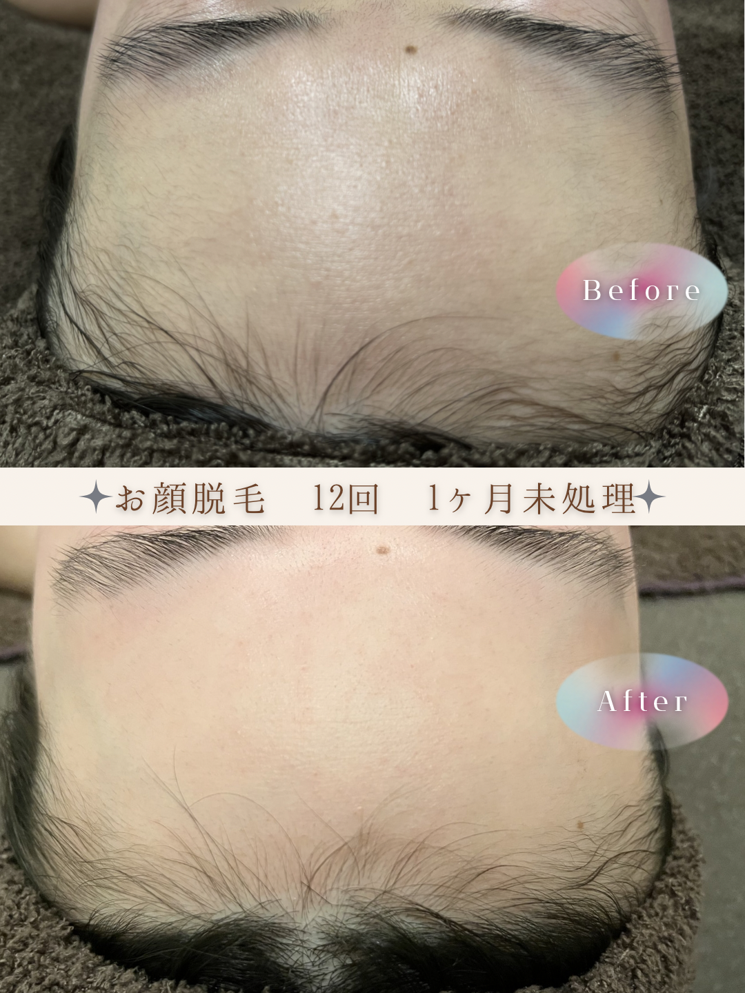 ブラウン　シンプル　美容　ビフォーアフター　写真　Instagram投稿　 (Instagramの投稿（34）).PNG