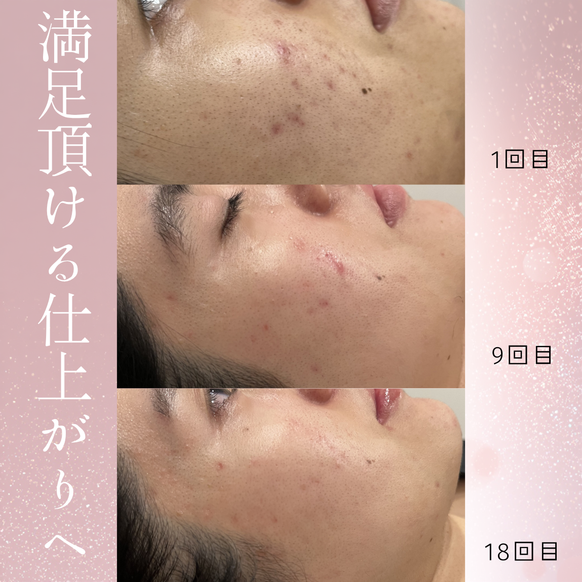 白黒　シンプル　ミニマル　3分割　仕事　日記　写真コラージュ　Instagramの投稿　縦長 (1150 x 1150 px) - 1.PNG