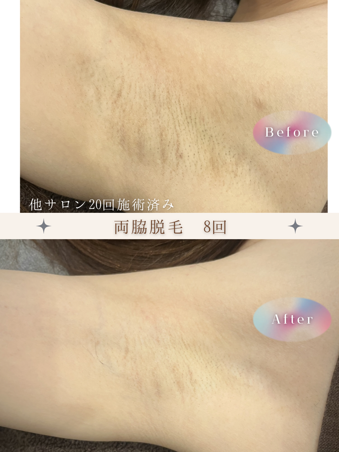 ブラウン　シンプル　美容　ビフォーアフター　写真　Instagram投稿　 (Instagramの投稿（34）).PNG