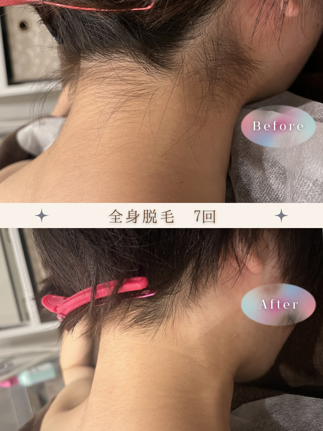 ブラウン　シンプル　美容　ビフォーアフター　写真　Instagram投稿　 (Instagramの投稿（34）).PNG