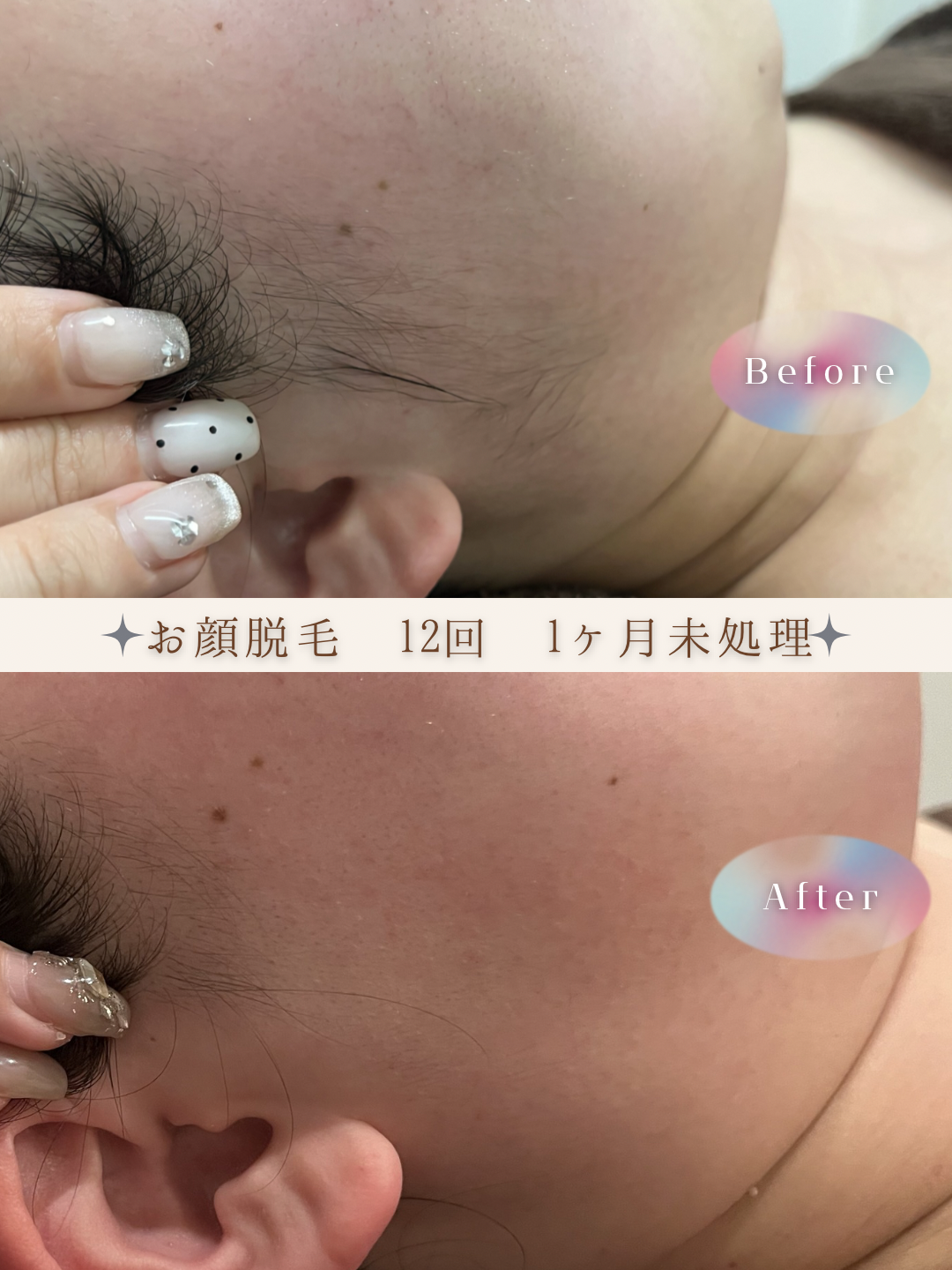 ブラウン　シンプル　美容　ビフォーアフター　写真　Instagram投稿　 (Instagramの投稿（34）).PNG