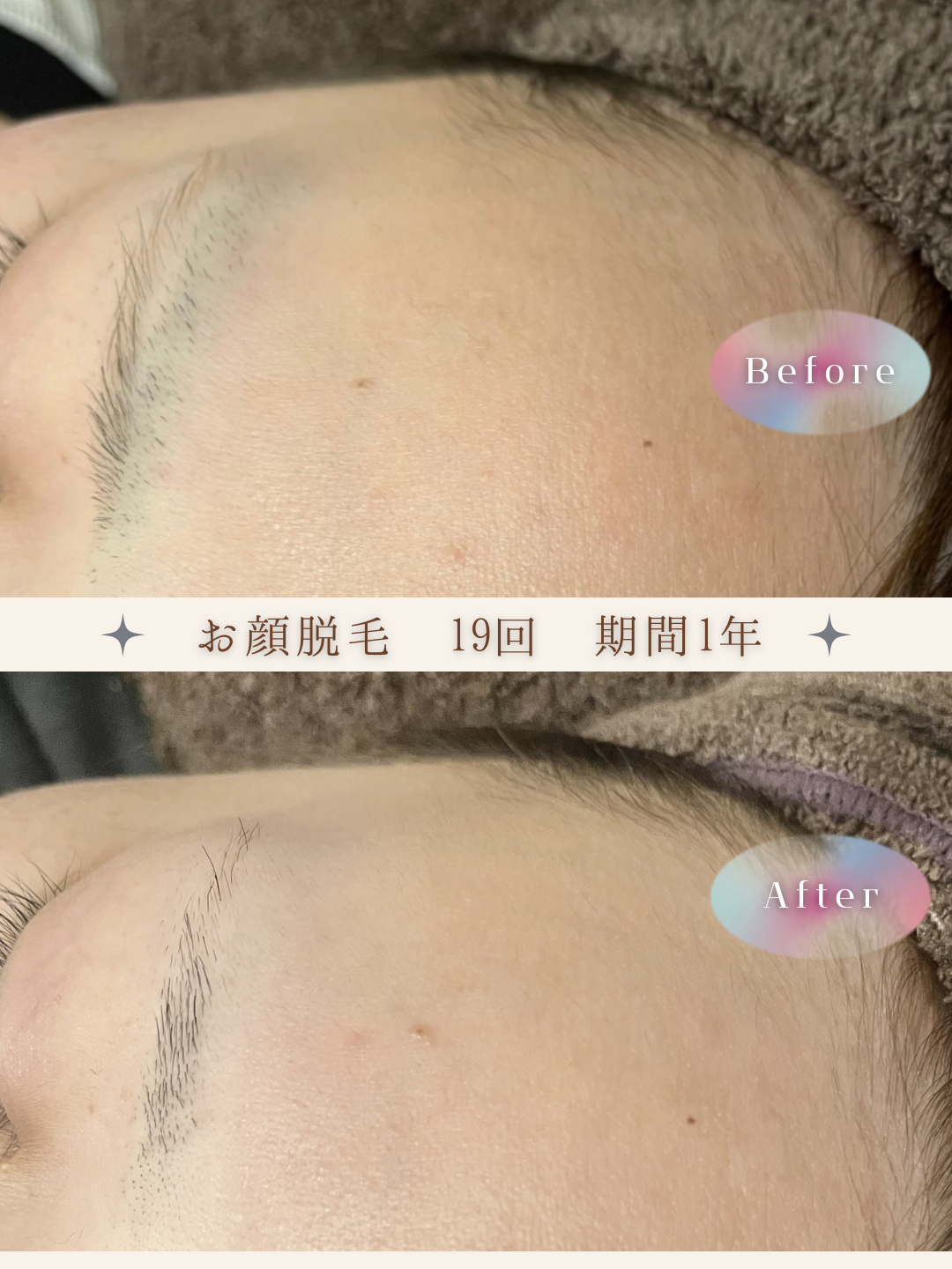 ブラウン　シンプル　美容　ビフォーアフター　写真　Instagram投稿　 (Instagramの投稿（34）).PNG