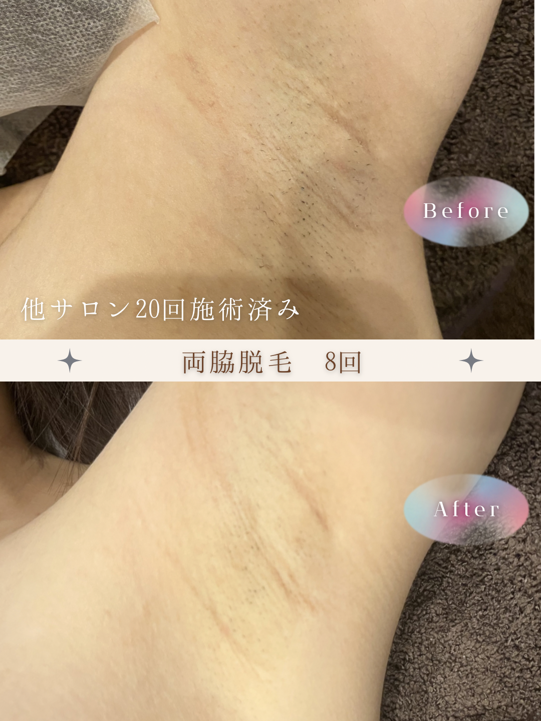 ブラウン　シンプル　美容　ビフォーアフター　写真　Instagram投稿　 (Instagramの投稿（34）).PNG