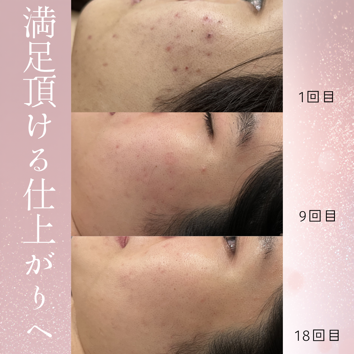 白黒　シンプル　ミニマル　3分割　仕事　日記　写真コラージュ　Instagramの投稿　縦長 (1150 x 1150 px) - 1.PNG