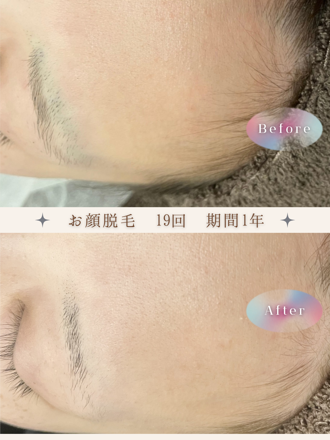 ブラウン　シンプル　美容　ビフォーアフター　写真　Instagram投稿　 (Instagramの投稿（34）).PNG