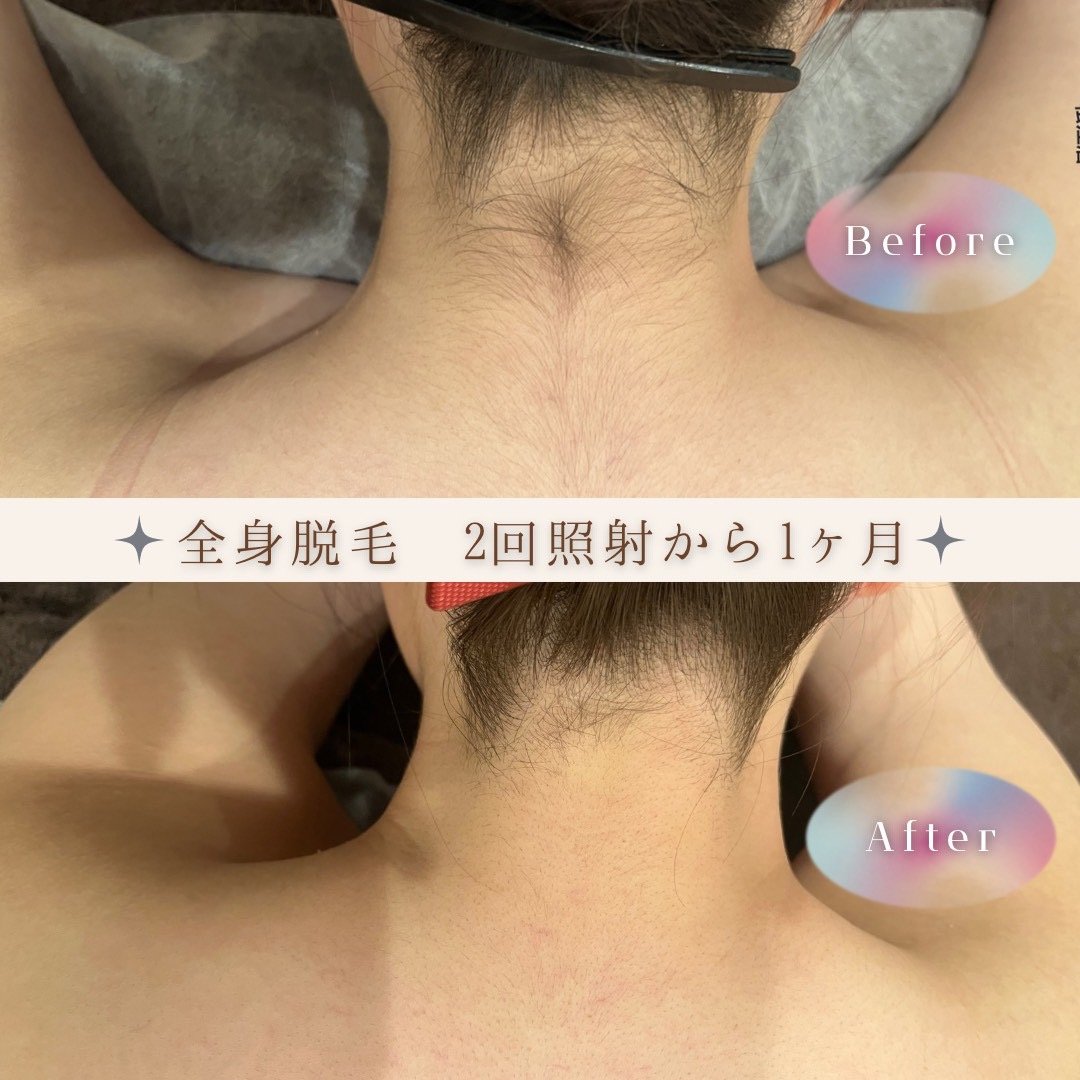 襟足山口.jpeg