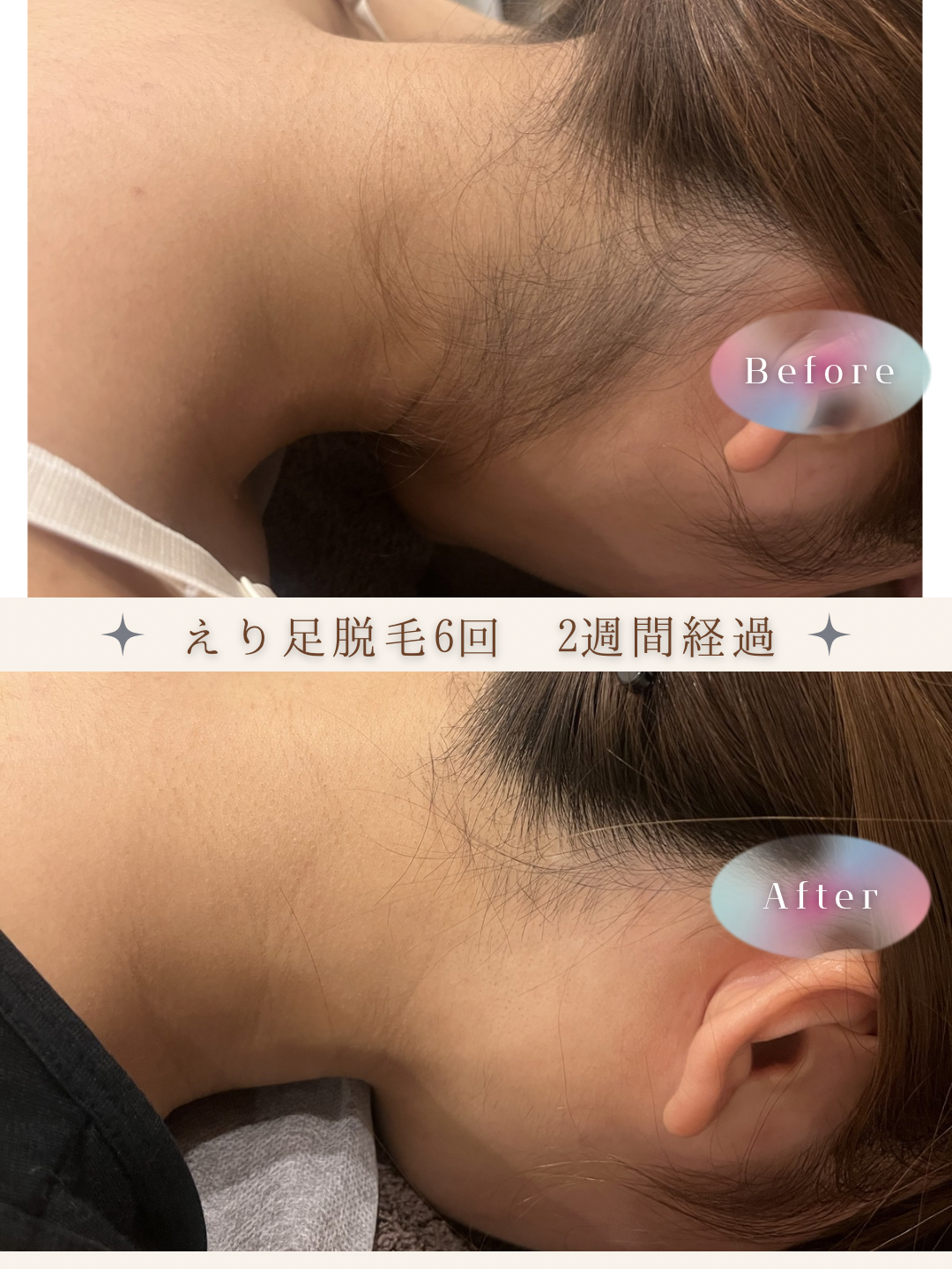 ブラウン　シンプル　美容　ビフォーアフター　写真　Instagram投稿　 (Instagramの投稿（34）).PNG