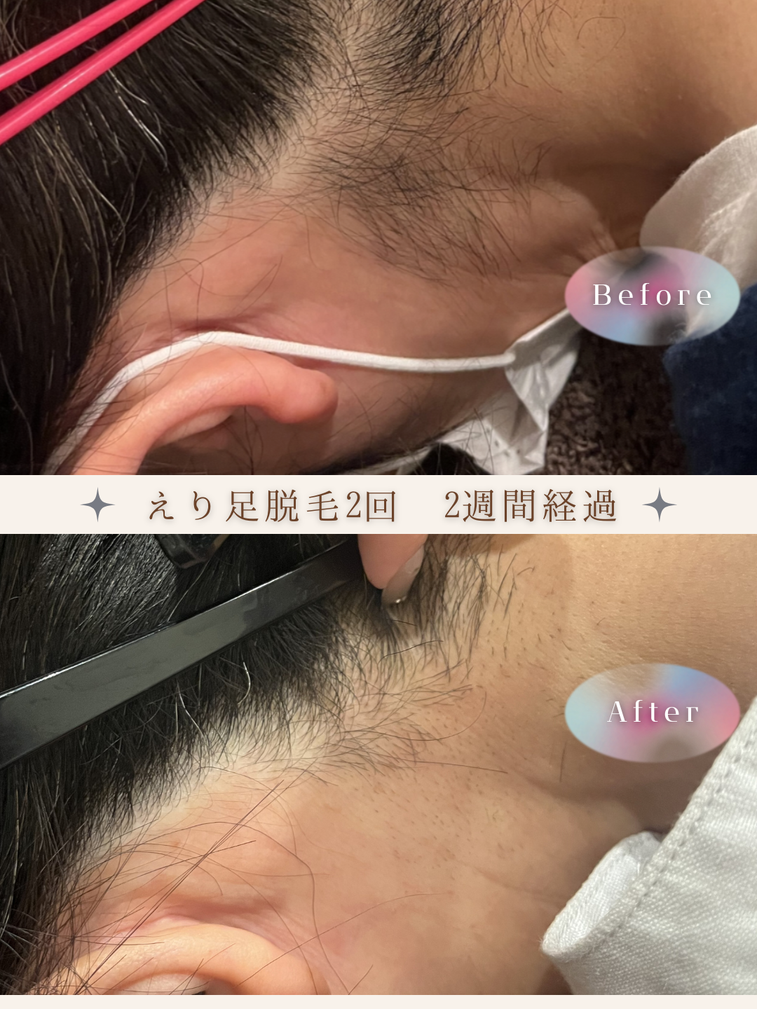 ブラウン　シンプル　美容　ビフォーアフター　写真　Instagram投稿　 (Instagramの投稿（34）).PNG