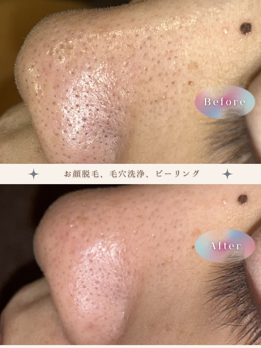 ブラウン　シンプル　美容　ビフォーアフター　写真　Instagram投稿　 (Instagramの投稿（34）).PNG