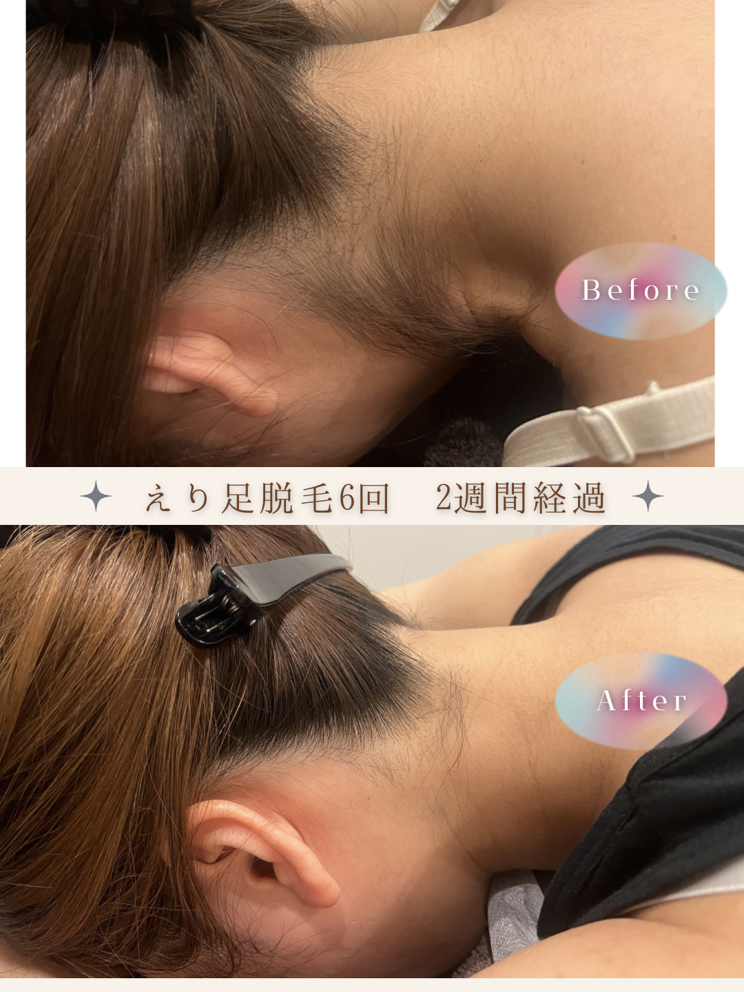 ブラウン　シンプル　美容　ビフォーアフター　写真　Instagram投稿　 (Instagramの投稿（34）).PNG