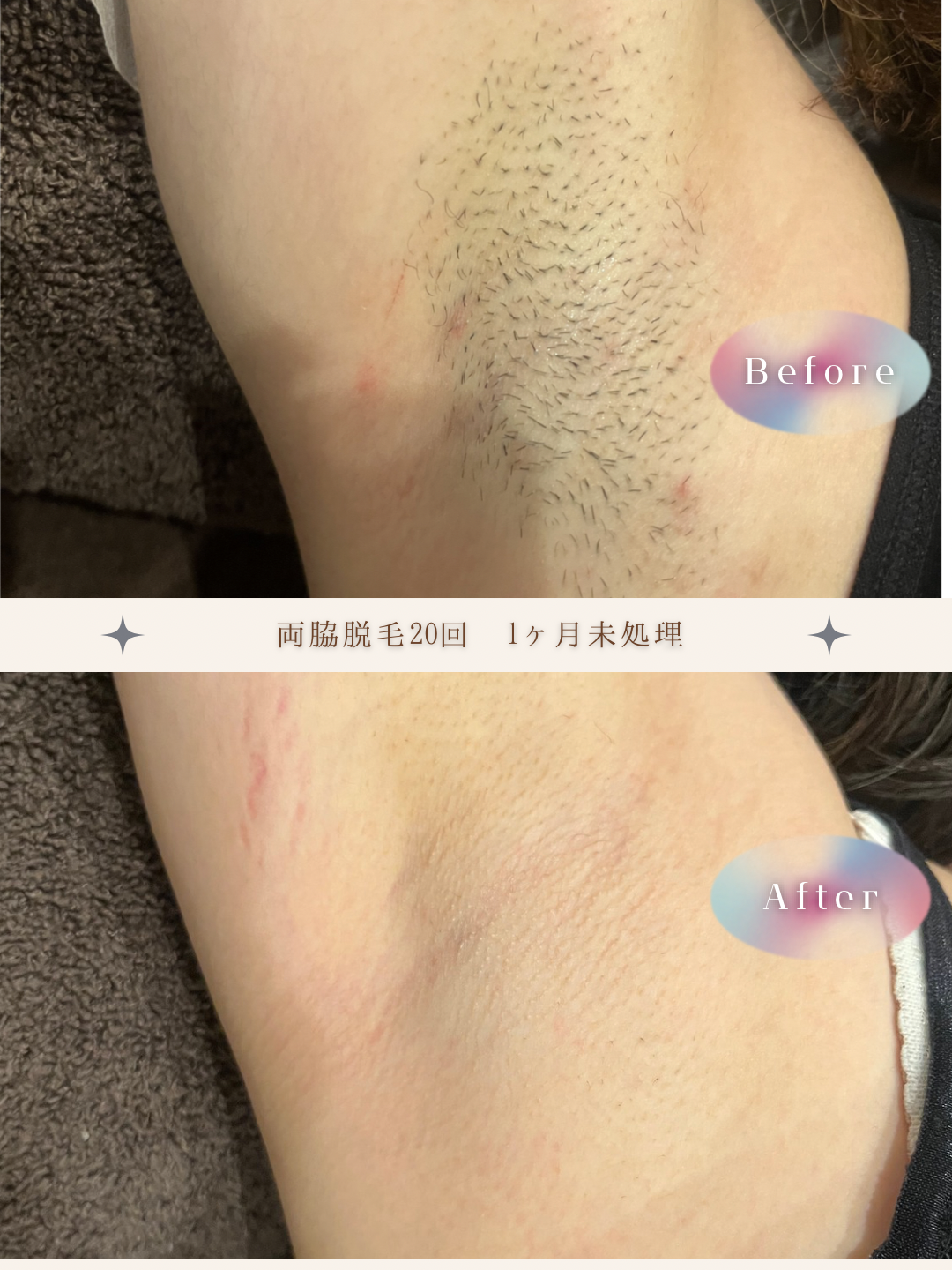 ブラウン　シンプル　美容　ビフォーアフター　写真　Instagram投稿　 (Instagramの投稿（34）).PNG