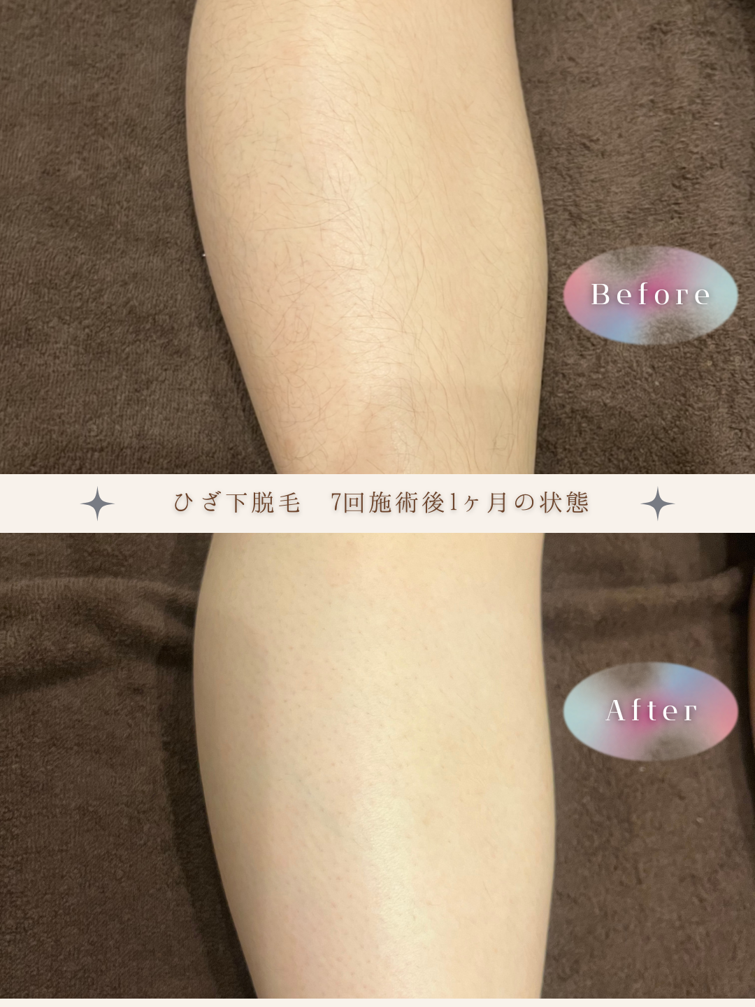 ブラウン　シンプル　美容　ビフォーアフター　写真　Instagram投稿　 (Instagramの投稿（34）).PNG