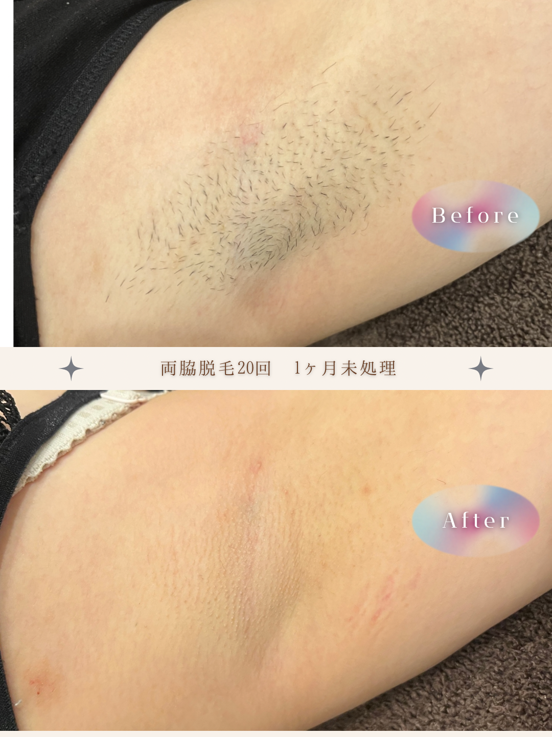 ブラウン　シンプル　美容　ビフォーアフター　写真　Instagram投稿　 (Instagramの投稿（34）).PNG