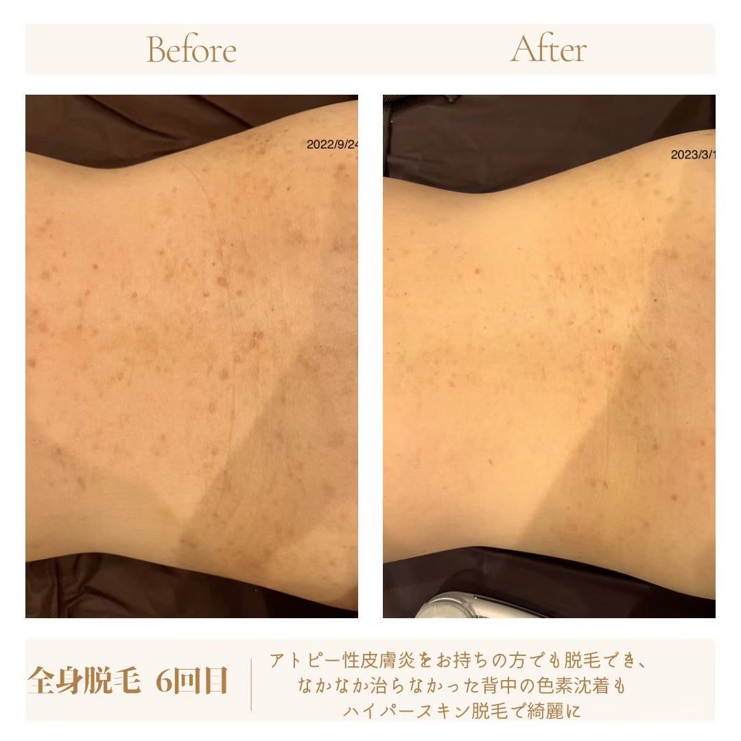 LINE_ALBUM_SNS画像_240820_9.jpg