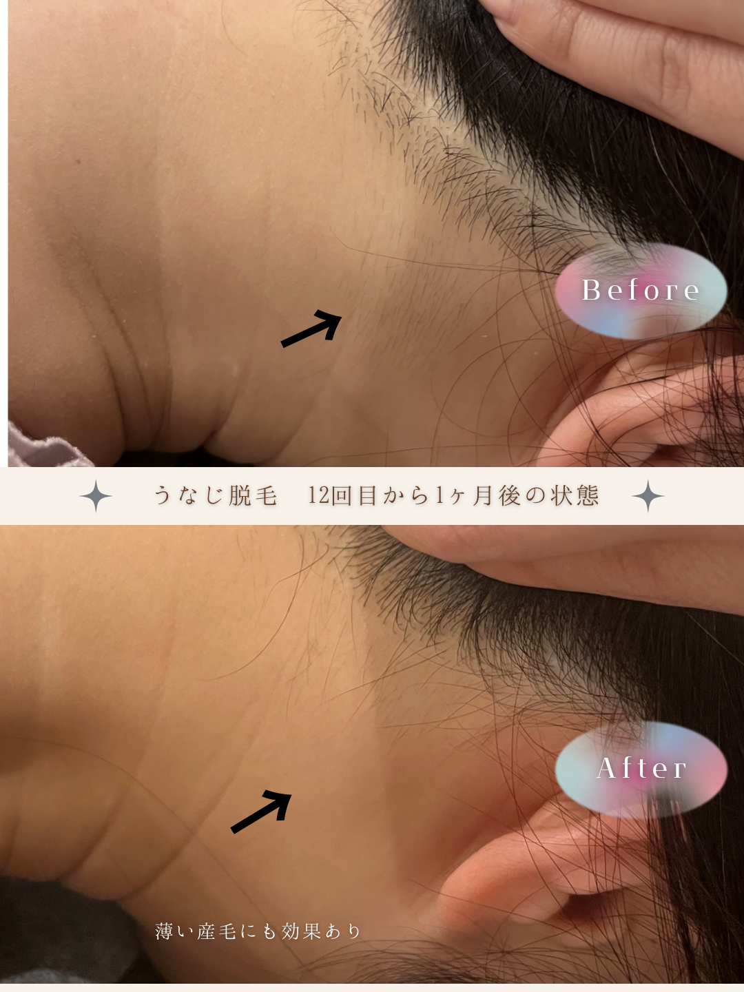 ブラウン　シンプル　美容　ビフォーアフター　写真　Instagram投稿　 (Instagramの投稿（34）).PNG