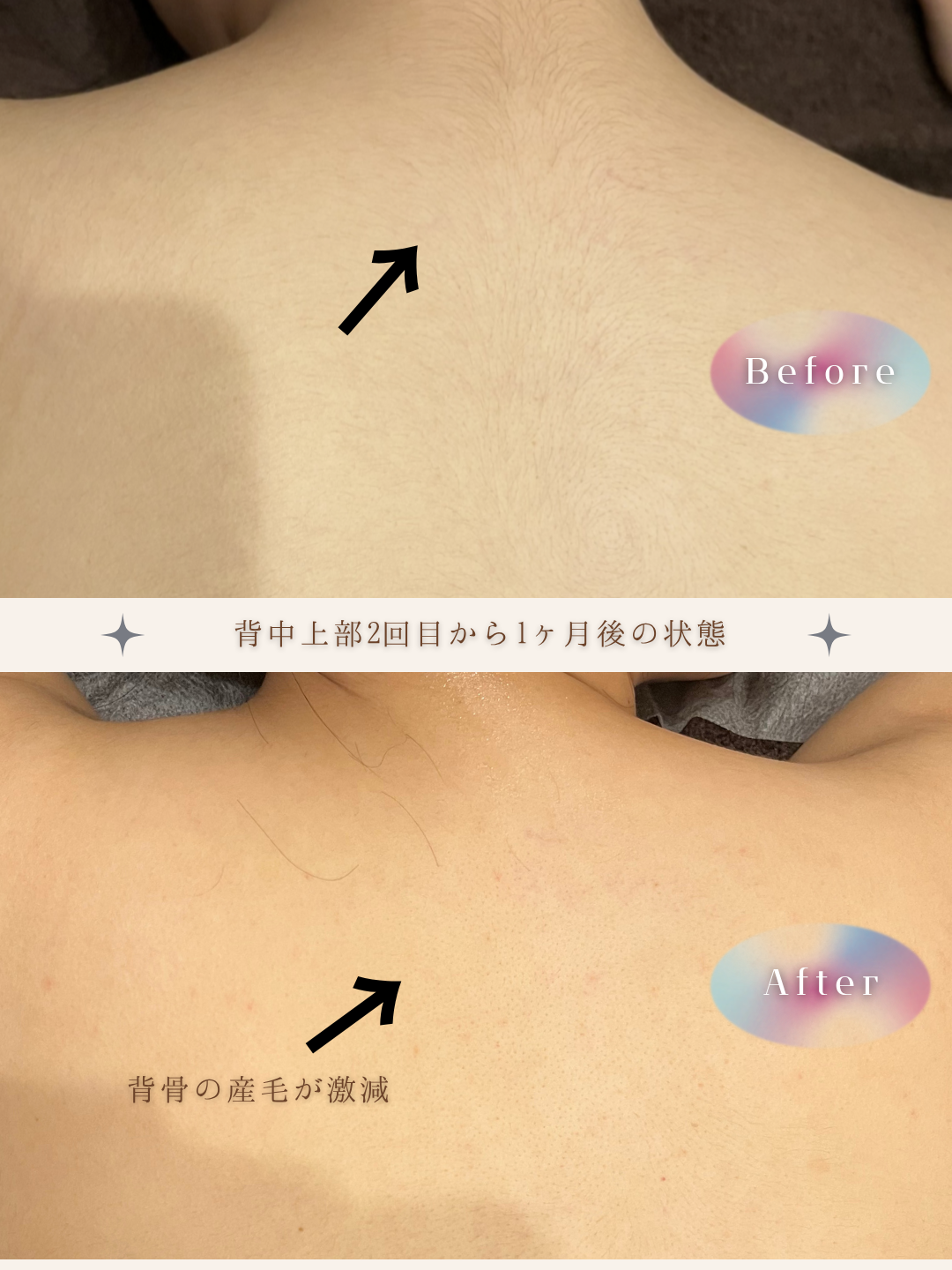 ブラウン　シンプル　美容　ビフォーアフター　写真　Instagram投稿　 (Instagramの投稿（34）).PNG