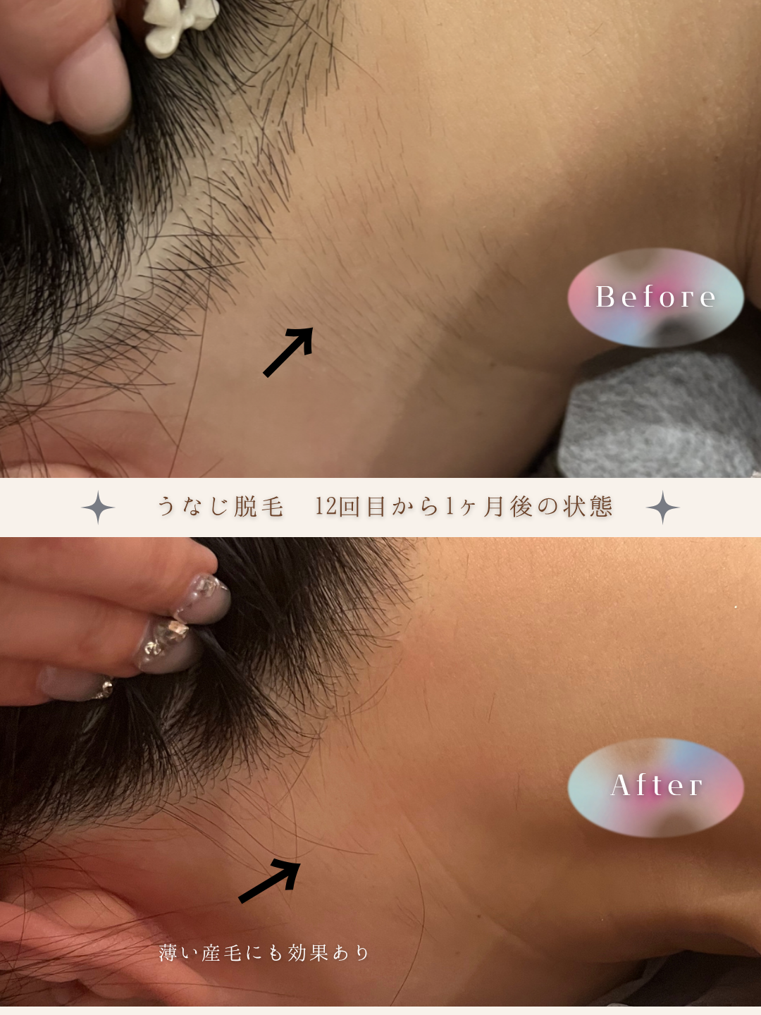 ブラウン　シンプル　美容　ビフォーアフター　写真　Instagram投稿　 (Instagramの投稿（34）).PNG