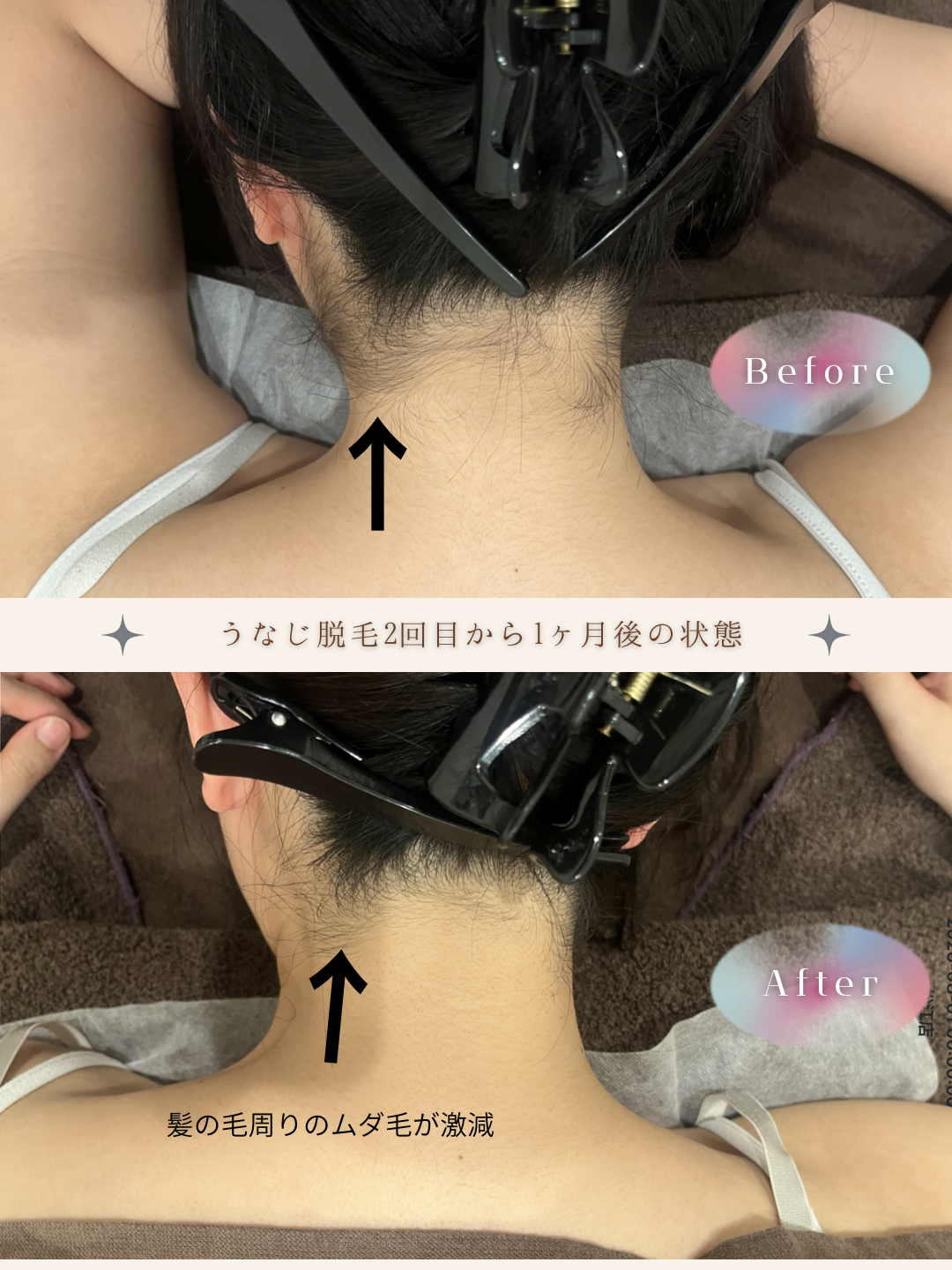 ブラウン　シンプル　美容　ビフォーアフター　写真　Instagram投稿　 (Instagramの投稿（34）).PNG
