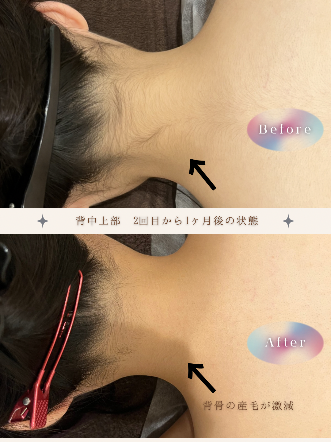 ブラウン　シンプル　美容　ビフォーアフター　写真　Instagram投稿　 (Instagramの投稿（34）).PNG