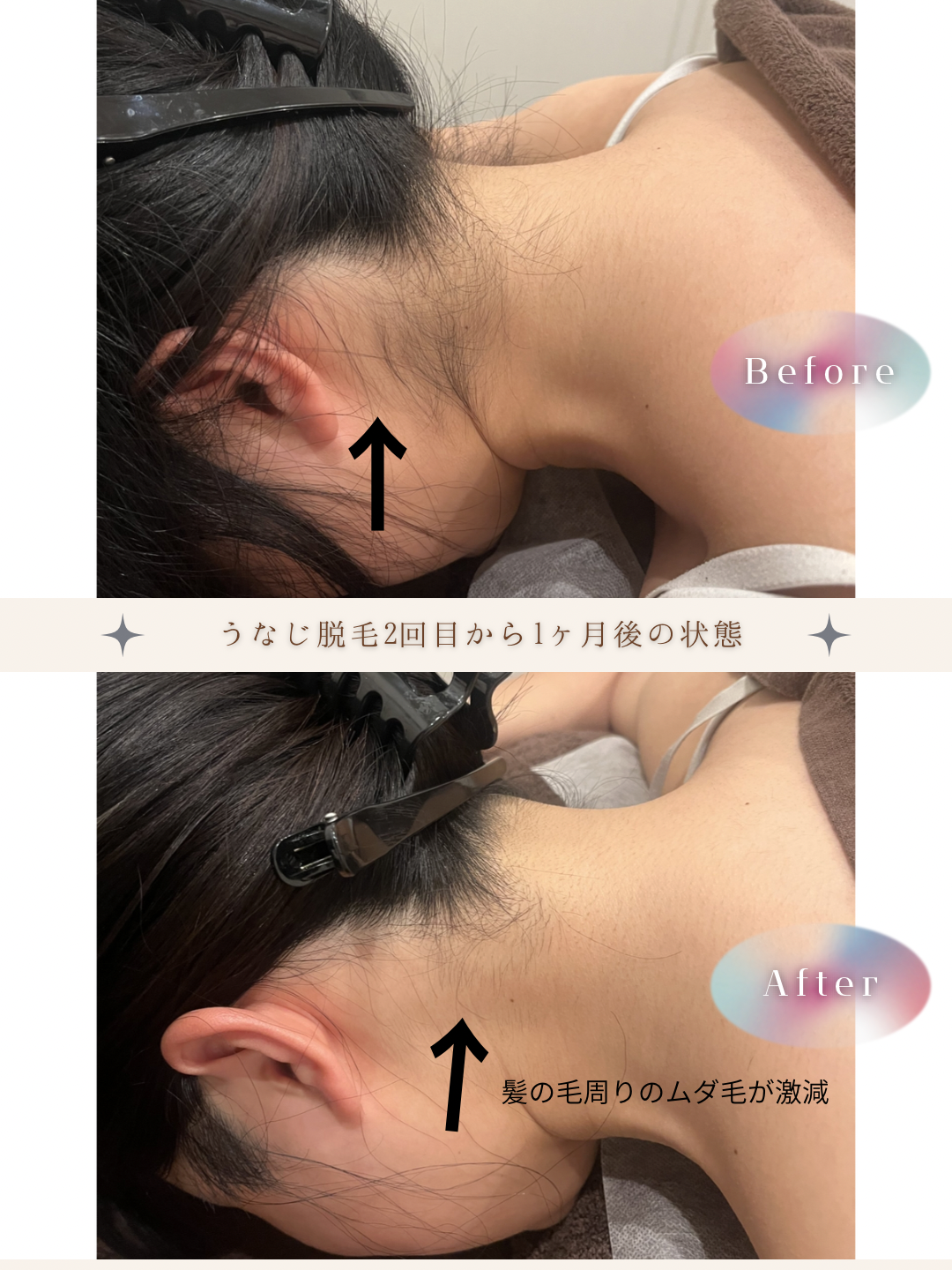 ブラウン　シンプル　美容　ビフォーアフター　写真　Instagram投稿　 (Instagramの投稿（34）).PNG