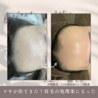 image1.jpeg